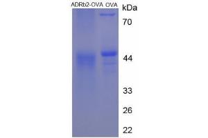Image no. 1 for Adrenergic, beta-2-, Receptor, Surface (ADRB2) peptide (Ovalbumin) (ABIN5666062) (Adrenergic, beta-2-, Receptor, Surface (ADRB2) peptide (Ovalbumin))