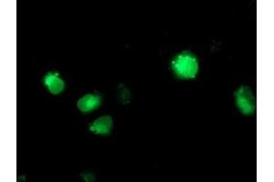 Anti-CYP2C9 mouse monoclonal antibody (ABIN2455199) immunofluorescent staining of COS7 cells transiently transfected by pCMV6-ENTRY CYP2C9 (RC220997). (CYP2C9 antibody)