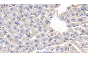Detection of CP in Rat Liver Tissue using Polyclonal Antibody to Ceruloplasmin (CP) (Ceruloplasmin antibody  (AA 872-1059))
