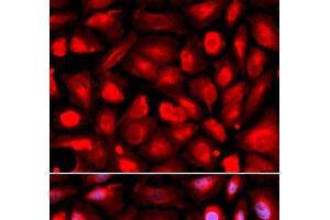 Immunofluorescence analysis of U2OS cells using ETS1 Polyclonal Antibody (ETS1 antibody)