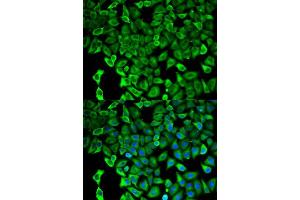 Immunofluorescence analysis of HeLa cell using PSMD2 antibody. (PSMD2 antibody  (AA 1-260))