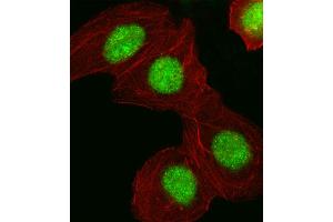Fluorescent image of A549 cell stained with HMGA1 Antibody . (HMGA1 antibody  (C-Term))