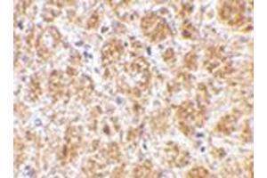 Immunohistochemistry of DARC in mouse brain tissue with DARC antibody at 2. (DARC antibody  (C-Term))