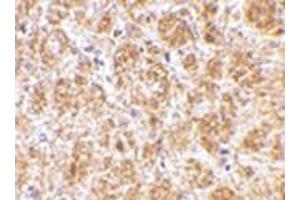 Immunohistochemistry of DARC in mouse brain tissue with DARC antibody at 2.