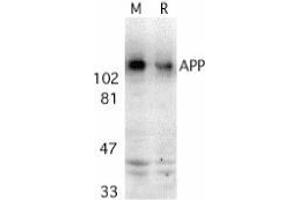 Western blot analysis of APP in mouse (M) and rat (R) brain tissue lysates with AP30071PU-N APP antibody at 2 μg/ml.
