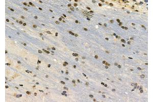 ABIN6263046 and ABIN6272340 at 1/100 staining Rat brain tissue by IHC-P. (CHRM4 antibody  (Internal Region))
