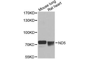 Western blot analysis of extracts of various cell lines, using ND5 antibody (ABIN6294088) at 1:1000 dilution. (MT-ND5 antibody)