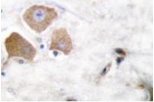 Image no. 2 for anti-Microtubule-Associated Protein tau (MAPT) (pSer396) antibody (ABIN318142) (MAPT antibody  (pSer396))