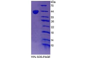 SDS-PAGE analysis of Human TR2 Protein. (NR2C1 Protein)