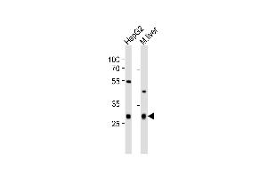 Western blot analysis of lysates from HepG2 cell line, mouse liver tissue lysate (from left to right), using CTDSP1 Antibody (N-term) (ABIN6243354 and ABIN6577527). (CTDSP1 antibody  (N-Term))