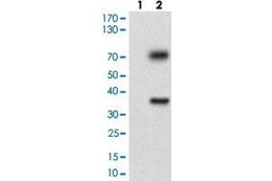 Western blot analysis of Lane 1: Negative control [HEK293 cell lysate]; Lane 2: Over-expression lysate [TUBE1 (AA: 314-472)-hIgGFc transfected HEK293 cells] with TUBE1 monoclonal antibody, clone 7G3B2  at 1:500-1:2000 dilution. (TUBE1 antibody  (AA 314-472))