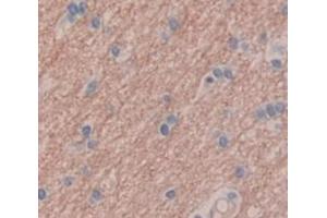 IHC-P analysis of Human Tissue, with DAB staining. (GRIP1 antibody  (AA 79-268))