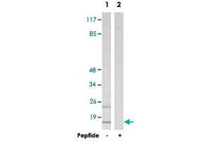 Western blot analysis of extracts from HepG2 cells, using MRPS16 polyclonal antibody .