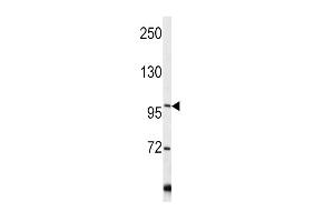 COL6A1 antibody  (C-Term)