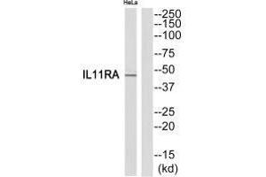 Western blot analysis of extracts from HeLa cells, using IL11RA antibody. (IL11RA antibody  (C-Term))