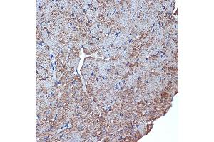 Immunohistochemistry of paraffin-embedded mouse heart using CDC42EP1 Rabbit mAb (ABIN7266231) at dilution of 1:100 (40x lens). (CDC42EP1 antibody)