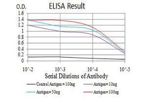Black line: Control Antigen (100 ng),Purple line: Antigen (10 ng), Blue line: Antigen (50 ng), Red line:Antigen (100 ng) (GRM7 antibody  (AA 454-590))