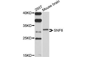 Western blot analysis of extracts of 293T and mouse brain cells, using SNF8 antibody.