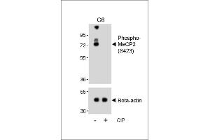 Western blot analysis of lysates from C6 cell line, untreated or treated with calf intestinal alkaline phosphatase(CIP), using Phospho-MeCP2 Antibody (upper) or Beta-actin (lower).