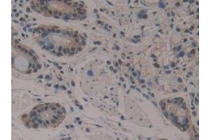 Immunohistochemistry (IHC) image for anti-Enolase 3 (Beta, Muscle) (ENO3) (AA 1-391) antibody (ABIN7443197)