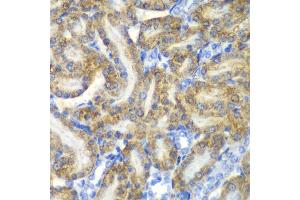 Immunohistochemistry of paraffin-embedded rat kidney using FAH antibody. (FAH antibody)