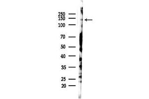 anti-Ubiquitin Specific Peptidase 40 (USP40) (C-Term) antibody