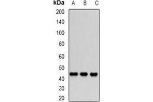Western blot analysis of Dnmt3L expression in PC3 (A), Jurkat (B), MCF7 (C) whole cell lysates. (DNMT3L antibody)