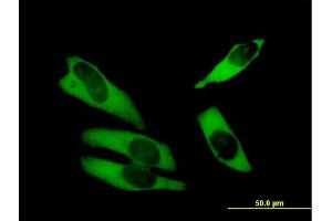 Immunofluorescence (IF) image for anti-ATP-Binding Cassette, Sub-Family F (GCN20), Member 1 (ABCF1) (AA 1-845) antibody (ABIN513036)