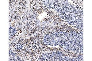 IHC analysis of GFPT1 using anti-GFPT1 antibody (ABIN7602887).
