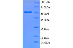 SDS-PAGE (SDS) image for Plasminogen Activator Inhibitor 1 (SERPINE1) (AA 24-401), (partial) protein (His tag) (ABIN5712768) (PAI1 Protein (AA 24-401, partial) (His tag))