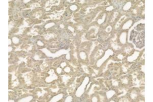 ABIN6258467 and ABIN6275239 at 1/100 staining human normal kidney tissue by IHC-P. (MRPS36 antibody  (Internal Region))