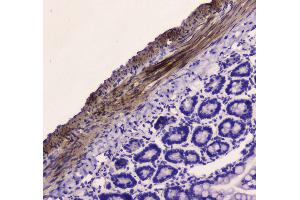 IHC analysis of MYLK using anti-MYLK antibody . (MYLK antibody  (AA 1441-1709))