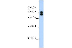 ALPP antibody used at 1. (PLAP antibody)