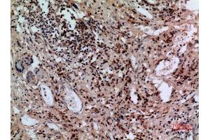 Immunohistochemistry (IHC) analysis of paraffin-embedded Human Lung, antibody was diluted at 1:100. (SLC10A1 antibody  (C-Term))