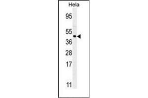 Western blot analysis of FOXL2 Antibody (N-term) in Hela cell line lysates (35ug/lane). (FOXL2 antibody  (N-Term))