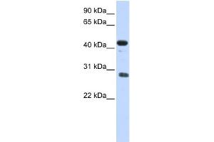 WB Suggested Anti-CDCA5 Antibody Titration: 0. (CDCA5 antibody  (Middle Region))
