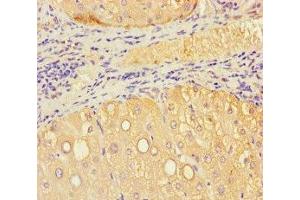 Immunohistochemistry of paraffin-embedded human liver tissue using ABIN7175549 at dilution of 1:100 (VMO1 antibody  (AA 25-202))