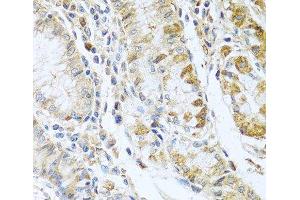 Immunohistochemistry of paraffin-embedded Human stomach using RNASE13 Polyclonal Antibody at dilution of 1:100 (40x lens). (RNASE13 antibody)