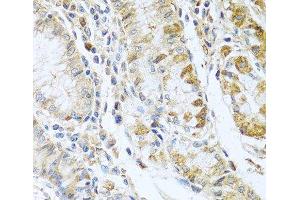 Immunohistochemistry of paraffin-embedded Human stomach using RNASE13 Polyclonal Antibody at dilution of 1:100 (40x lens).