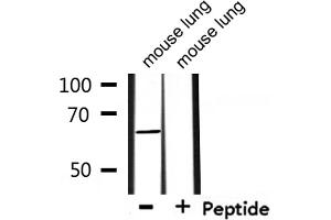 ADCK5 antibody  (N-Term)