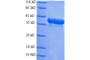 SDS-PAGE (SDS) image for Transient Receptor Potential Cation Channel, Subfamily M, Member 3 (TRPM3) (AA 24-120) protein (His-SUMO Tag) (ABIN4974819) (TRPM3 Protein (AA 24-120) (His-SUMO Tag))