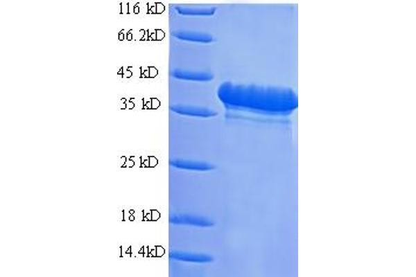 TRPM3 Protein (AA 24-120) (His-SUMO Tag)