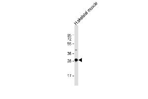 Anti-DNASE1L2 Antibody (C-Term) at 1:2000 dilution + human skeletal muscle lysate Lysates/proteins at 20 μg per lane. (DNASE1L2 antibody  (AA 199-229))