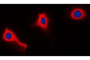 Immunofluorescent analysis of p47 phox (pS370) staining in THP1 cells. (NCF1 antibody  (C-Term, pSer370))