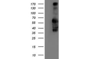 Western Blotting (WB) image for anti-Iduronate 2-Sulfatase (IDS) antibody (ABIN1498798) (IDS antibody)
