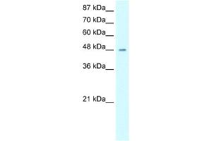 WB Suggested Anti-HMG20A Antibody Titration:  0. (HMG20A antibody  (Middle Region))