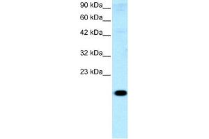 WB Suggested Anti-CITED1 Antibody Titration:  0. (CITED1 antibody  (Middle Region))