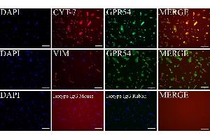 Characterization of primary cultures of first trimester trophoblast cells. (KISS1R antibody  (C-Term))