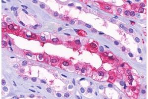 Anti-GPR91 antibody  ABIN1048899 IHC staining of human kidney, medulla. (SUCNR1 antibody  (Cytoplasmic Domain))