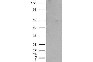 Western Blotting (WB) image for Retinoid X Receptor, beta (RXRB) peptide (ABIN369746) (Retinoid X Receptor, beta (RXRB) Peptide)